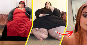 La star de “Obésité : Mon corps, ma prison”, Amber Rachdi, devient une légende vivante après avoir perdu 171 kg