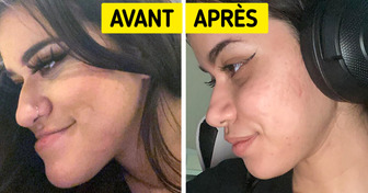 16 Personnes qui ont transformé leur apparence grâce à la chirurgie esthétique