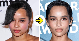 15 Célébrités qui ont troqué leurs joues rebondies pour des pommettes sculptées