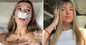 Une inflienceuse se fait refaire le nez pour que ses “futurs enfants naissent avec un joli nez”