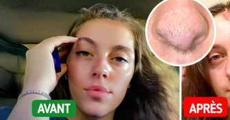 Elle est mordue par son chien, puis un phénomène incroyable commence à apparaître sur son visage