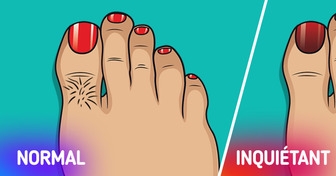 9 Signaux que tes pieds peuvent révéler sur ton état de santé