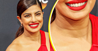 13 Célébrités qui prouvent qu’on peut briller avec des imperfections