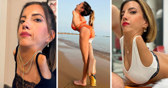 Cette femme est née sans bras et sans une jambe, mais aujourd’hui elle change le monde
