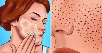 8 Erreurs de soin de la peau qui donnent l’impression que tes pores sont encore plus dilatés