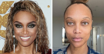 15 Stars qui prouvent qu’on n’a pas besoin de maquillage pour se sentir belle
