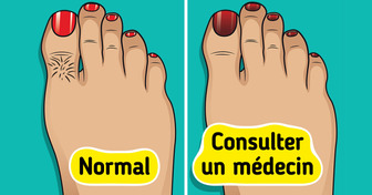 9 Choses que tes pieds peuvent révéler sur ta santé (et que tu ne devrais pas ignorer)