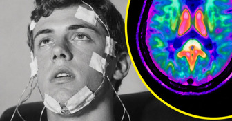 Il est resté éveillé 264 heures... mais cette expérience aurait changé sa vie pour toujours