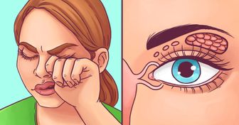 10 Conseils simples et naturels très utiles si tu souffres de sécheresse oculaire !