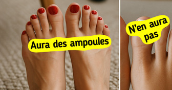 6 Conseils efficaces pour éviter les ampoules quand tu marches