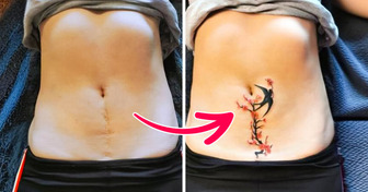 16 Tatoueurs qui ont donné une seconde vie à des cicatrices