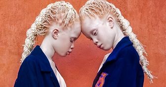 Il y a un an, ces jumelles ont fait sensation sur Internet, découvre comment elles sont aujourd’hui
