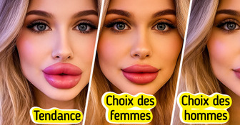Les hommes et les femmes n’ont pas la même définition de lèvres parfaites, d’après la science