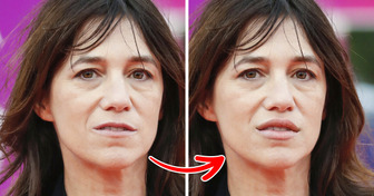 À quoi ressembleraient ces 15 célébrités sans leur trait emblématique