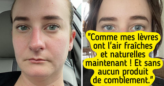 15 Paires de photos de personnes vraiment heureuses de leur changement