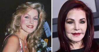 13 Avant-après de stars que la chirurgie esthétique a totalement transformées