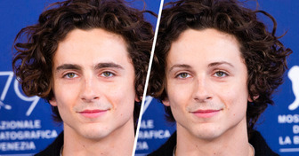 Voici à quoi ressemblent 15 célébrités sans leur signe particulier le plus marquant