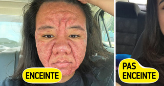Une jeune femme de 28 ans parle sans filtre des changements physiques dus à la grossesse