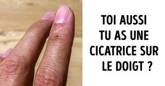 Des internautes se sont rendu compte que nous avions tous une cicatrice en commun sur l’index ainsi que d’autres caractéristiques étranges...