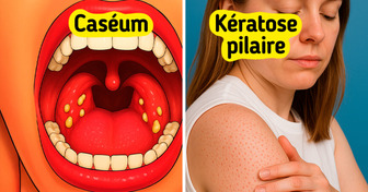 14 Signes que ton corps pourrait être sensible au gluten