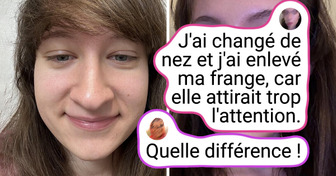 12 Femmes ont révélé comment la chirurgie plastique a changé leur visage
