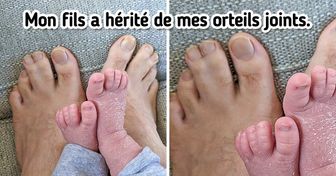15 Photos qui prouvent que nos différences sont des super-pouvoirs dont nous devrions être fiers