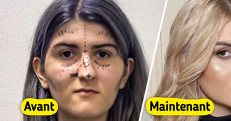 Elle subit une chirurgie complète en Corée du Sud et sa métamorphose enflamme la toile