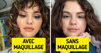 17 Célébrités qui n’hésitent pas à se montrer au naturel, sans maquillage