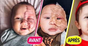 Une maman, traitée de “monstre” pour avoir fait enlever la tache de naissance de son bébé, brise le silence