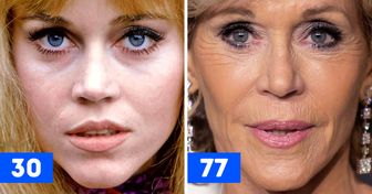 20 Comparaisons de gros plans de célébrités qui montrent comment elles ont changé avec le temps