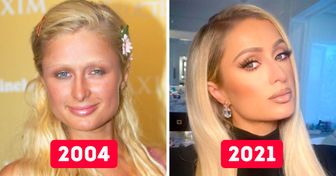 15+ Célébrités qui ont beaucoup changé depuis les années 2000