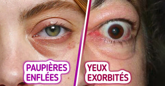 12 Signes étranges dans tes yeux qui pourraient cacher un souci de santé