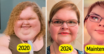 La star de “Sœurs de poids” fait sensation avec son nouveau look après une chirurgie de la peau