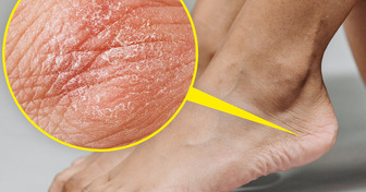 11 Signes subtils sur ta santé que tes pieds essaient de te montrer