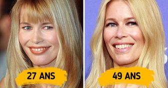14 Сélébrités qui ont renoncé aux liftings et au botox et se sont autorisées à être elles-mêmes