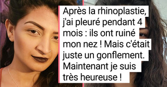 20+ Photos où la comparaison fait toute la différence
