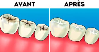 8 Réponses d’un dentiste concernant les questions les plus courantes que l’on se pose sur les soins dentaires