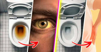 7 Alertes au niveau de ta santé que ton urine peut révéler