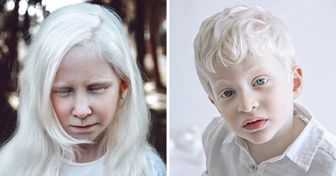 Une photographe capture des personnes atteintes d’albinisme pour montrer leur beauté merveilleuse et unique