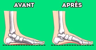 7 Exercices conseillés par les orthopédistes pour rehausser la voûte plantaire et soulager les douleurs aux pieds