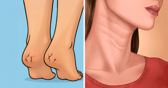 8 Symptômes de problèmes de peau qui doivent t’alerter sur ton état de santé