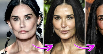 Des experts expliquent ce qui est arrivé au visage de Demi Moore