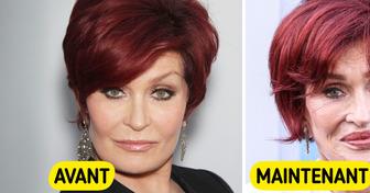 “Je crois que je suis allée trop loin” : à 72 ans, Sharon Osbourne révèle enfin la vérité sur sa transformation