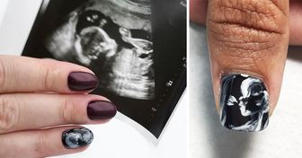 Des femmes enceintes utilisent leurs échographies comme manucure, et le résultat est tout à fait surprenant !