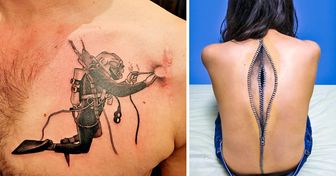 Les tatouages peuvent transformer des cicatrices en œuvres d’art, et ces photos le prouvent !