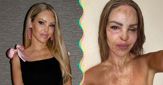 “J’ai atteint le bout du chemin” : Katie Piper fait le point 16 ans après son agression à l’acide