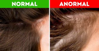 Ce que l’état de tes cheveux révèle sur ta santé