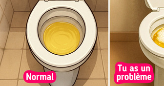 9 Signes de problèmes rénaux que tu remarques souvent trop tard
