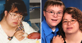 Une femme atteinte de trisomie 21 donne naissance à un garçon atteint de la même maladie et l’élève seule