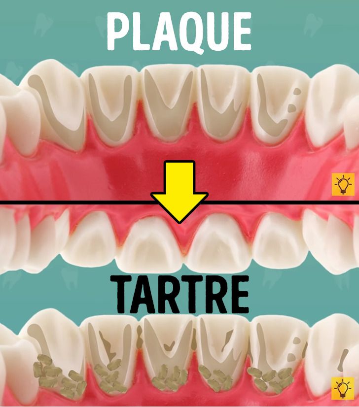 Si Tu Oublies De Te Brosser Les Dents Avant D aller Au Lit Voici Ce 